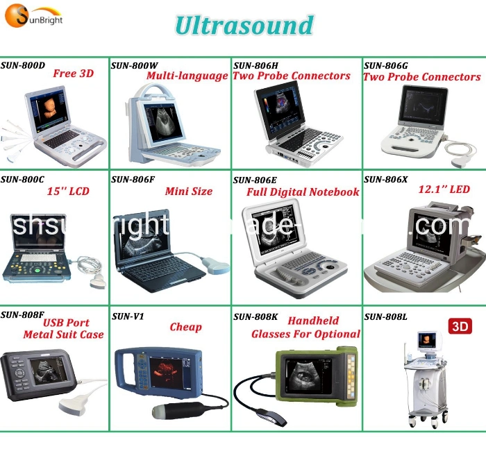15&quot; LED 3D Ob Gyn Obstetrics Trolley Ultrasound Machine 3D Trolley Ultrasound Device